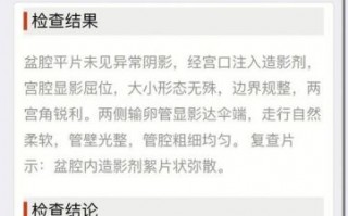 叶丽仪：从艰难起步到音乐巅峰的传奇人生