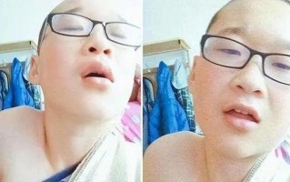 唏嘘！14岁爆火的网红少年，如今要看精神科：一步踏错终身错？