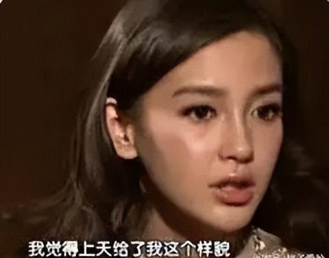 长得“歪瓜裂枣”，整得“美若天仙”，这6位女星都靠脸逆天改命-第22张图片-九妖电影