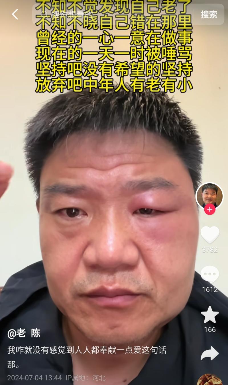 网红老陈“脸肿”上热搜，文案悲伤受委屈，网友：这是被人打了？-第2张图片-九妖电影